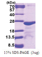 MYL5 (1-173, His-tag) Human Protein