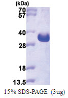 LAT (28-233, His-tag) Human Protein