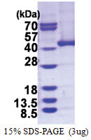 Alcohol dehydrogenase 5 / ADH5 (1-374, His-tag) Human Protein