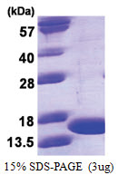 Tumor necrosis factor (TNF-alpha) (80-235) Mouse Protein