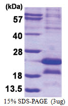 MAGE-5 (1-124, His-tag) Human Protein
