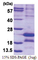 MAGE-5 (1-124, His-tag) Human Protein