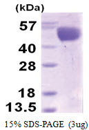 Influenza A H3N2 (Haemagglutinin) (17-345, His-tag) Protein