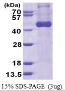 Interleukin-12 beta / IL12B (23-328, His-tag) Human Protein