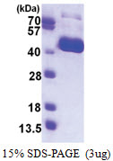 Influenza A H1N1 (A/New York/3571/2009 (18-344, His-tagged)) Protein