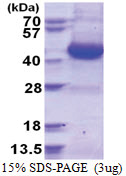 G Protein alpha Inhibitor 3 (1-354, His-tag) Human Protein
