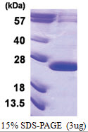 VPS29 (His-tag) Human Protein