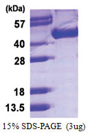 Influenza A H5N1 (Vietnam 1203/04 Hemagglutinin (17-338, His-tagged)) Protein