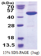 METAP1 (1-386, His-tag) Human Protein