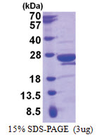 RANGRF / MOG1 (1-186, His-tag) Human Protein RANGRF / MOG1 (1-186, His-tag) Human Protein
