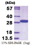 CMBL (1-245, His-tag) Human Protein