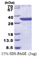 THG1L / ICF45 (30-298, His-tag) Human Protein