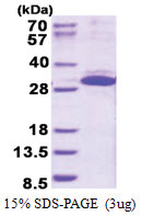 ITGB1BP3 / NRK2 (1-230, His-tag) Human Protein