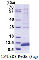 SYCE3 (1-88, His-tag) Human Protein