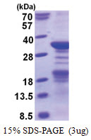 Nucleoplasmin 2 (1-214, His-tag) Human Protein