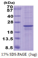 FOPNL (1-174, His-tag) Human Protein