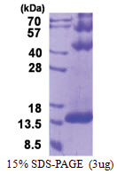 DYNLT3 (1-116, His-tag) Human Protein