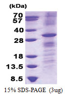 RhoV (1-236, His-tag) Human Protein