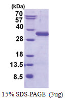 UBTD2 (1-234, His-tag) Human Protein
