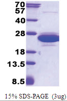 CNRIP1 (1-164, His-tag) Human Protein CNRIP1 (1-164, His-tag) Human Protein