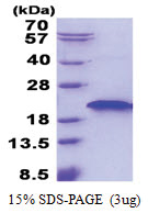 RNF181 (1-153, His-tag) Human Protein