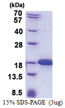 IFT20 (1-132, His-tag) Human Protein