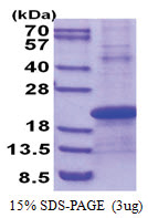 STELLAR / DPPA3 (1-159, His-tag) Human Protein