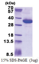 MRTO4 (1-239, His-tag) Human Protein