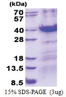 MBD3 (1-291, His-tag) Human Protein
