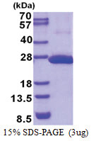 COMMD9 (1-198, His-tag) Human Protein