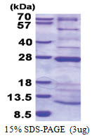 NDUFAF4 (1-175, His-tag) Human Protein