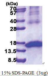 CD314 / KLRK1 (73-216, His-tag) Human Protein