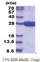 MRRF (56-262, His-tag) Human Protein