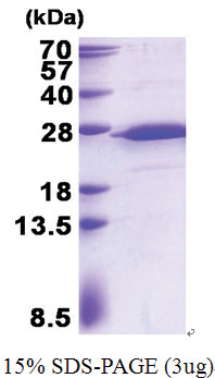 RPS5 (1-204, His-tag) Human Protein