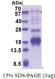 POLR2I (1-125, His-tag) Human Protein