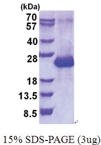 Amelotin (17-209, His-tag) Human Protein