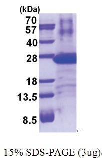 PSMB8 (73-276, His-tag) Human Protein