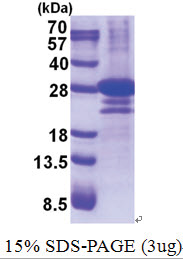 DTD1 (1-209, His-tag) Human Protein