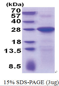 LIN7C (1-197, His-tag) Human Protein