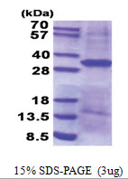 CD326 / EPCAM / TACSTD1 (24-265, His-tag) Human Protein