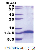 FDCSP / C4orf7 (18-85, His-tag) Human Protein