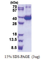 Galectin-9 (1-322, His-tag) Mouse Protein