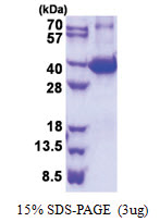 Galectin-9 (1-322, His-tag) Mouse Protein