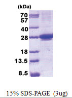 MIS12 (1-205, His-tag) Human Protein MIS12 (1-205, His-tag) Human Protein