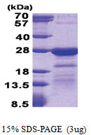 HN1L (1-190, His-tag) Human Protein