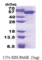 TBCEL / LRRC35 (1-424, His-tag) Human Protein