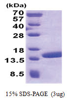 POLR2J2 (1-115, His-tag) Human Protein