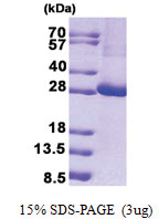 KCTD11 (1-232, His-tag) Human Protein