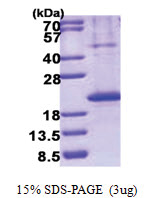CD267 / TACI (1-165, His-tag) Human Protein