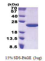 MCTS1 (1-181, His-tag) Human Protein